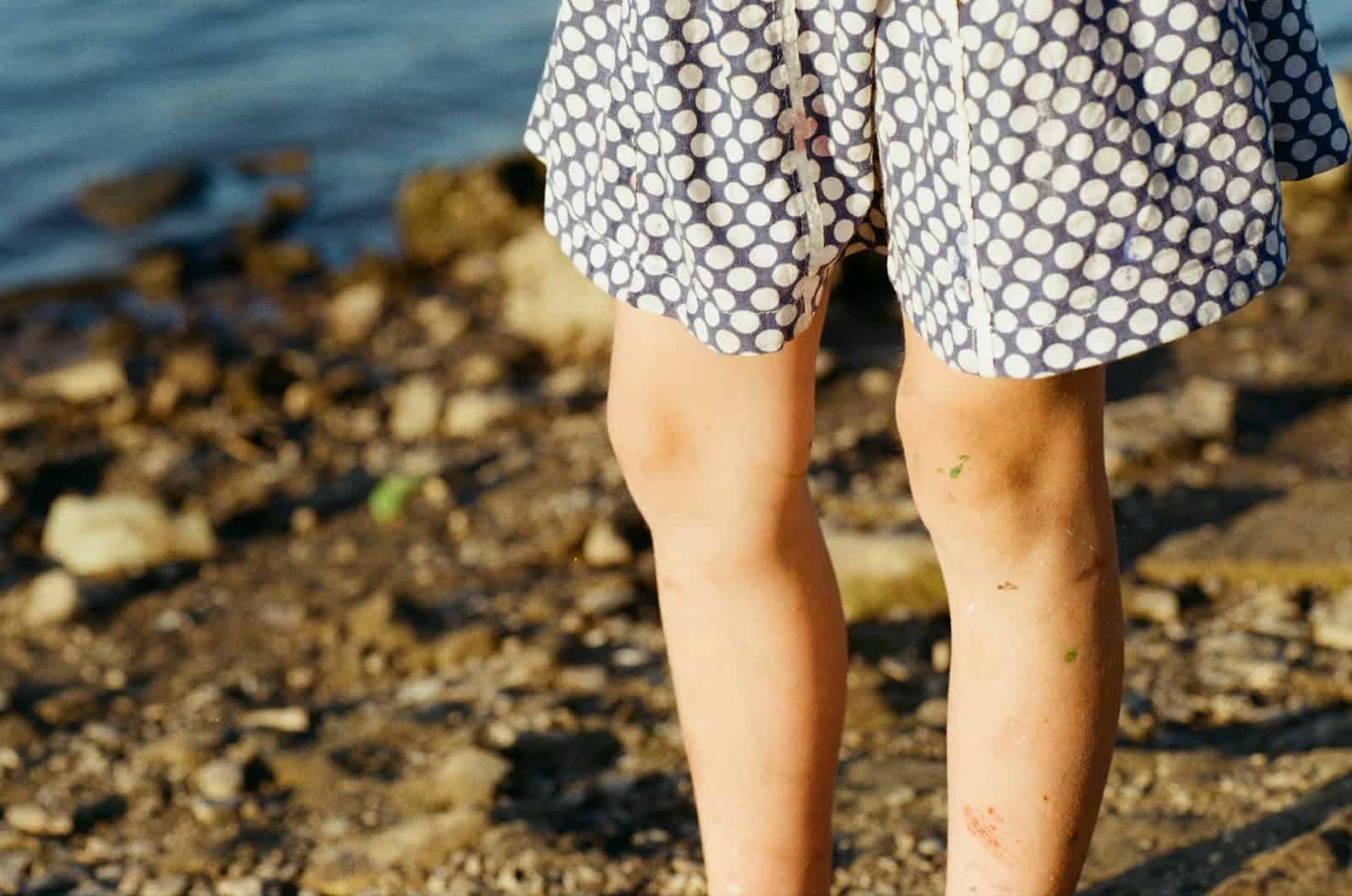 選對關節保健品,才能真正照顧行動力 / Photo by Klara Kulikova on Unsplash